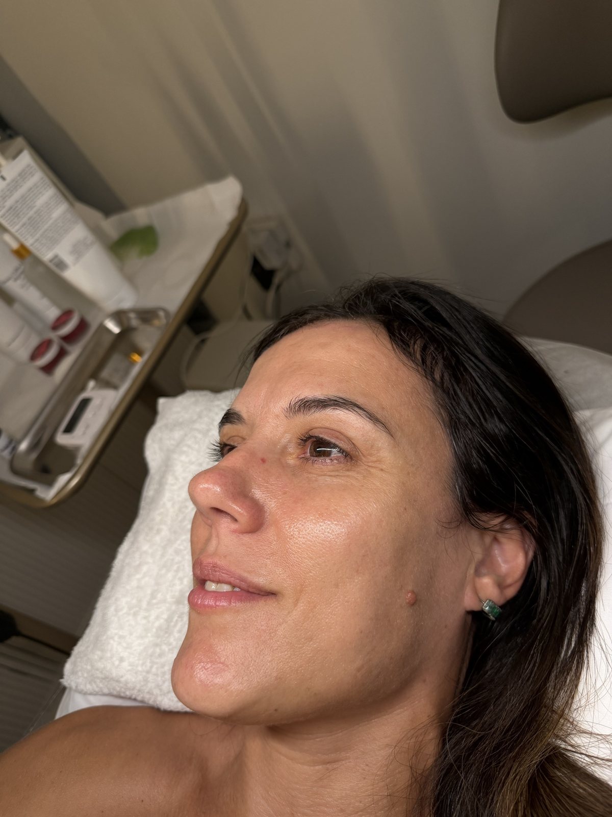Piel hidratada después del facial